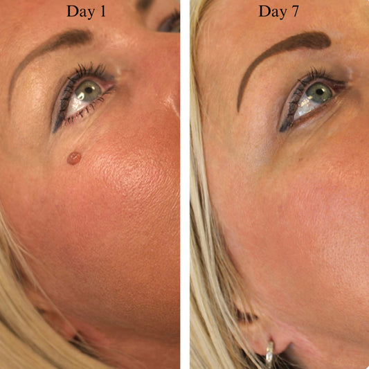 Clearskin